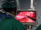Laparoscopic Sleeve Gastrectomy_2